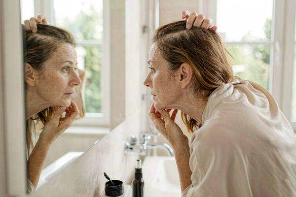 stylist measuring a larger crown bald spot before choosing a hair topper
