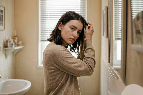 dandruff flakes and thinning hair on scalp